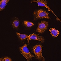 Anti-TRH Antibody