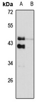 TRIB2 Rabbit Polyclonal Antibody
