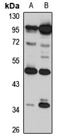 TRIM15 Antibody