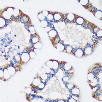 Anti-TRIM62 Antibody