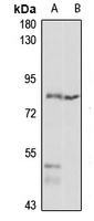 TRMT1 Rabbit Polyclonal Antibody