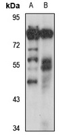TRPV6 Rabbit Polyclonal Antibody