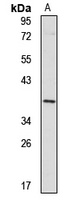TRUB2 Antibody