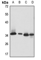 EF-Ts Rabbit Polyclonal Antibody