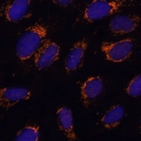 EF-Ts Rabbit Polyclonal Antibody