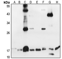 Thyrotropin beta Rabbit Polyclonal Antibody