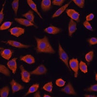Anti-TSLP Antibody