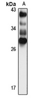 TSPAN3 Rabbit Polyclonal Antibody