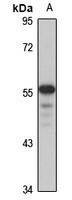 TUB Rabbit Polyclonal Antibody