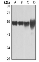 Tubulin beta-8 Rabbit Polyclonal Antibody