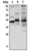 Twinfilin-1 Rabbit Polyclonal Antibody