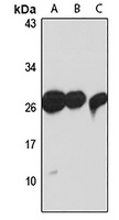 TXNDC9 Antibody