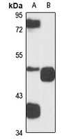 VDUP1 Rabbit Polyclonal Antibody