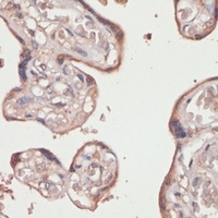 TXNRD1 antibody