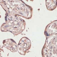 Anti-TXNRD1 Antibody