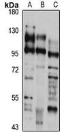 TYRO3 Rabbit Polyclonal Antibody