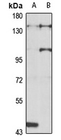 SR140 Rabbit Polyclonal Antibody