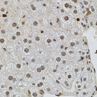 Anti-SR140 Antibody