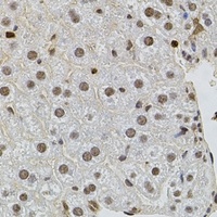 SR140 antibody