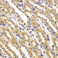 Anti-UBA3 Antibody