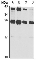 UBE2K Antibody