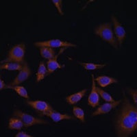 Anti-UBE2L6 Antibody