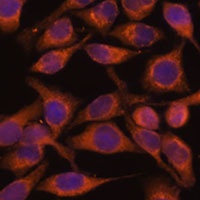Anti-UBQLNL Antibody