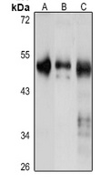 UBR7 Rabbit Polyclonal Antibody