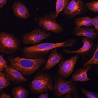 Anti-UFC1 Antibody