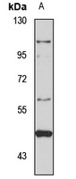UGT1A10 Rabbit Polyclonal Antibody