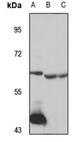 UGT2B15 Rabbit Polyclonal Antibody