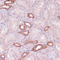UGT2B15 Rabbit Polyclonal Antibody