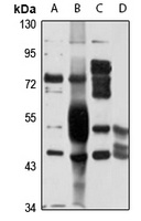 UGT2B4 Antibody