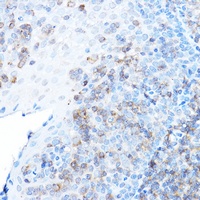 ULBP1 antibody