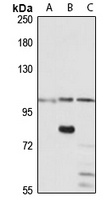UNC5C Rabbit Polyclonal Antibody