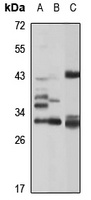 Uroplakin 3a Rabbit Polyclonal Antibody