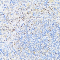 Anti-UQCC2 Antibody