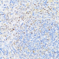 UQCC2 antibody