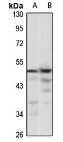 USP12 Rabbit Polyclonal Antibody