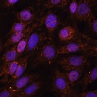Anti-USP18 Antibody