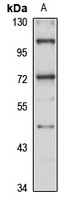USP2 Rabbit Polyclonal Antibody
