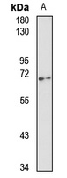 USP22 Rabbit Polyclonal Antibody