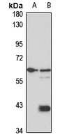 USP22 Rabbit Polyclonal Antibody