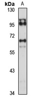 USP3 Rabbit Polyclonal Antibody