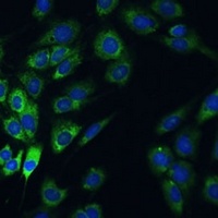 Anti-USP46 Antibody