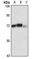 UTP6 Rabbit Polyclonal Antibody