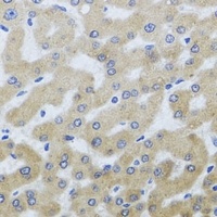 Anti-UVRAG Antibody