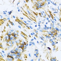 VAMP-1 Antibody