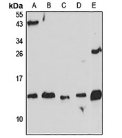 Endobrevin Rabbit Polyclonal Antibody
