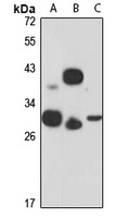 VAP-A Rabbit Polyclonal Antibody